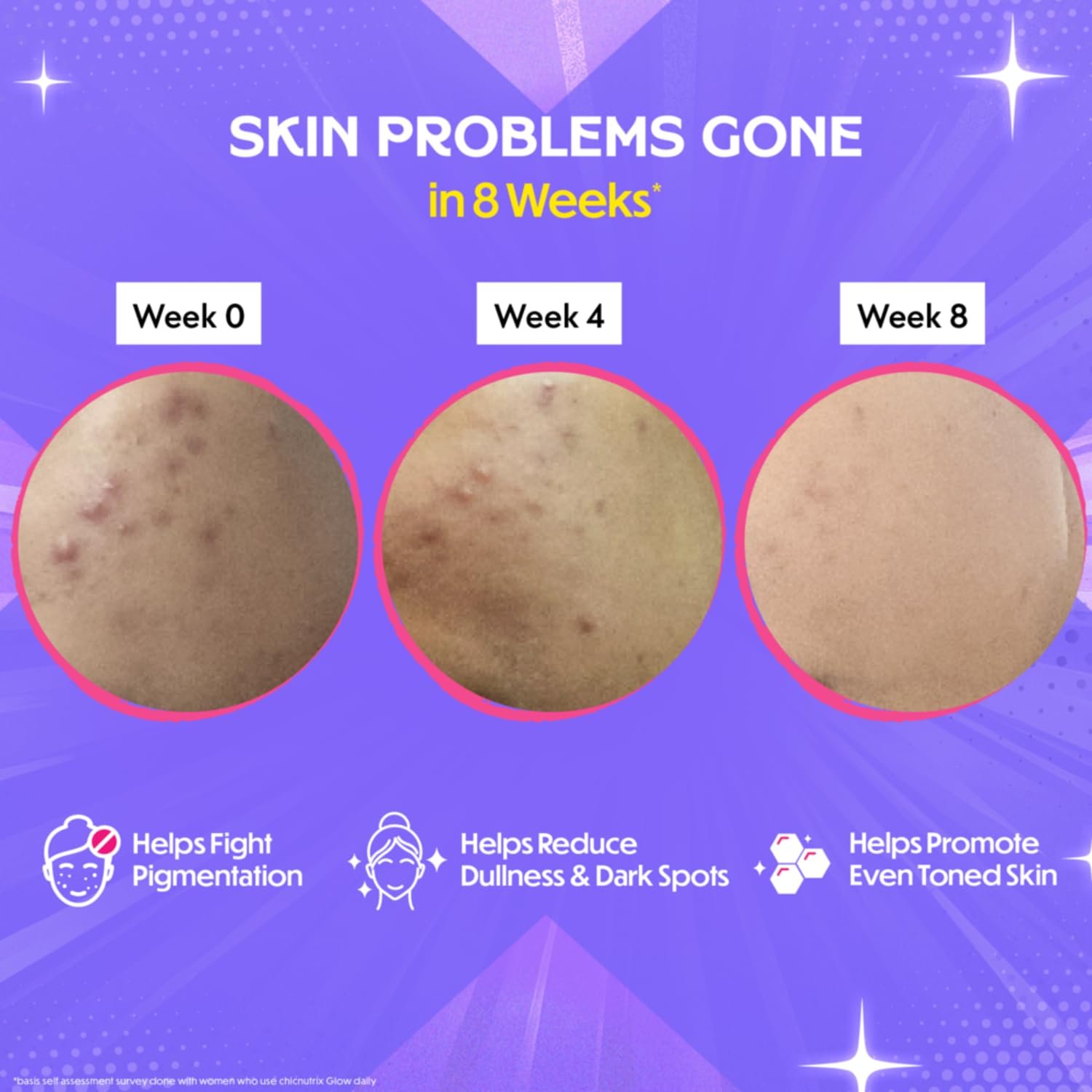 Chicnutrix Glow Japanese Glutathione 500mg OPITAC with Vitamin C Effervescent Tablets | Antioxidant, Detox & Skin Glow Support | Non-GMO, Vegan, Sugar-Free | Strawberry Lemon Flavor | 20 Tablets