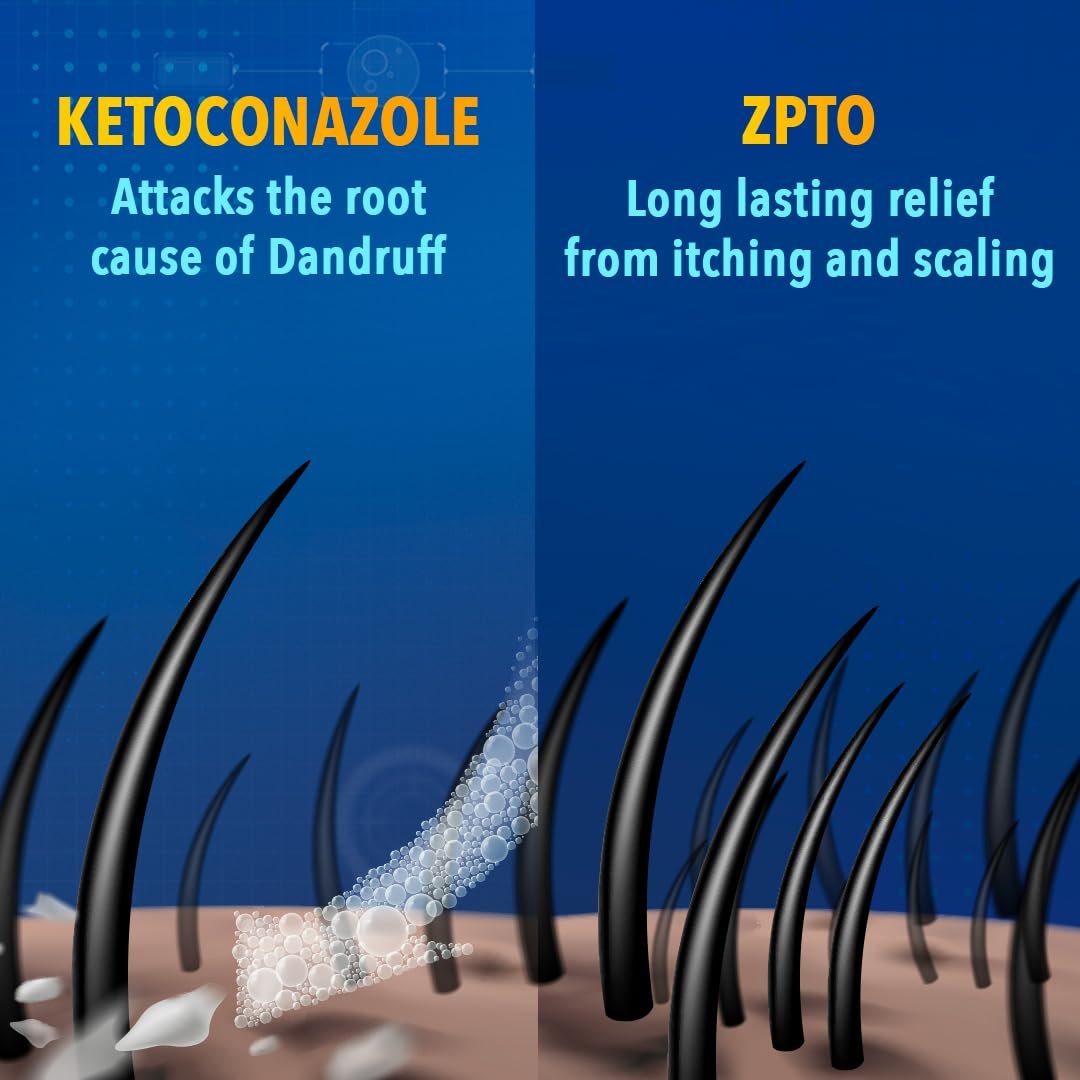 Scalpe+ Expert - Bottle of 75ml Anti Dandruff Shampoo for Men and Women with Ketoconazole and ZPTO